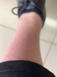 -成都西区医院整形美容