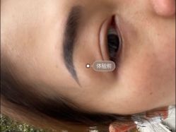 -广州健丽·去眼袋医疗美容机构