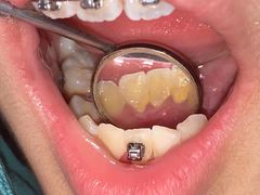 -齐玉齿科JADENTAL