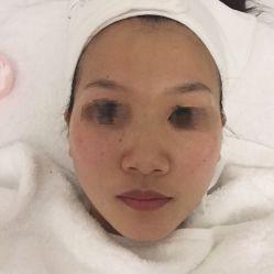 -Yukina Plus专业日式美肌