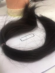 -大麦微针植发全国连锁