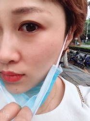 体验后-JUVA欧华医美连锁