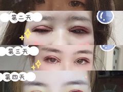 -上海大学附属上海和平眼科医院