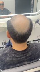 -唐风采假发补发定制