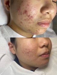 -美肤盾祛痘·问题肌头疗管理中心