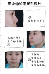 -北京米扬丽格医疗美容·联合丽格鼻整形中心