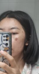 -皮肤激光医学中心