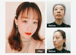 -SKINIST丽铂医疗美容