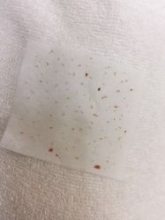 -苗方清颜祛痘·皮肤管理