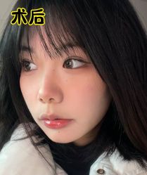 -素美医疗美容·西南眼鼻整形·修复基地