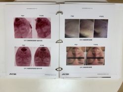 -小梨·OndaPro·专业脱毛连锁机构
