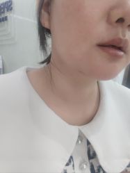-广州美莱医疗美容医院