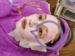 -蕾特恩祛痘•皮肤管理