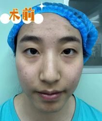 -素美医疗美容·西南眼鼻整形·修复基地