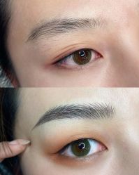 -郡艺医疗美容·微整·眼鼻吸脂