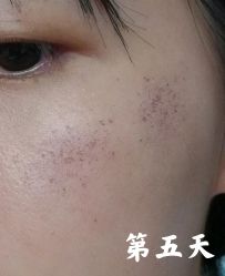 -Yestar宁波艺星整形医院