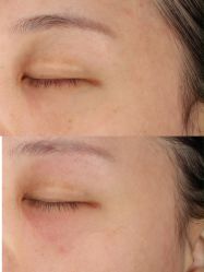 -深圳芙必优医疗美容·抗衰中心