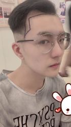 -大麦微针植发丨全国连锁