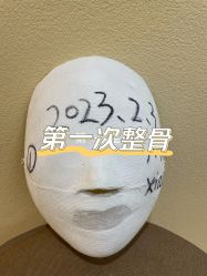 -小颜秘家·韩国整骨