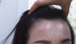 -雍禾植发全国连锁