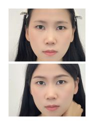 -杨益美学·野生眉半永久纹眉发际线