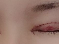 -中国人民解放军联勤保障部队第九〇三医院(九里松院区)