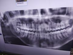 -土豆口腔(凤凰北总店)