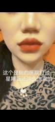 体验前-上海漾颜医疗美容