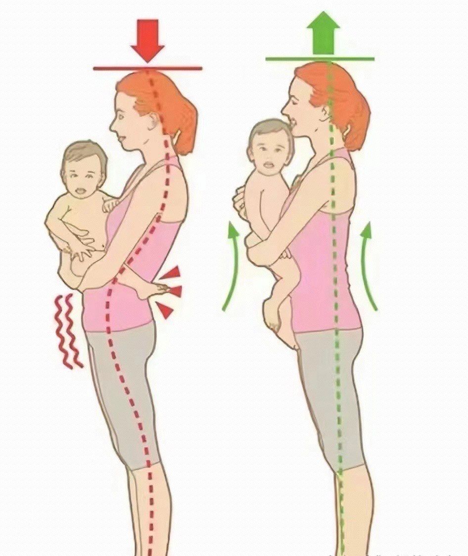 无力,
会让整个骨盆往前顶出去#"髋超伸"

长久保持这种姿势,会