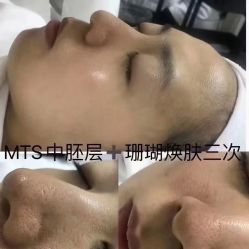 -苗方清颜痘肌研究所