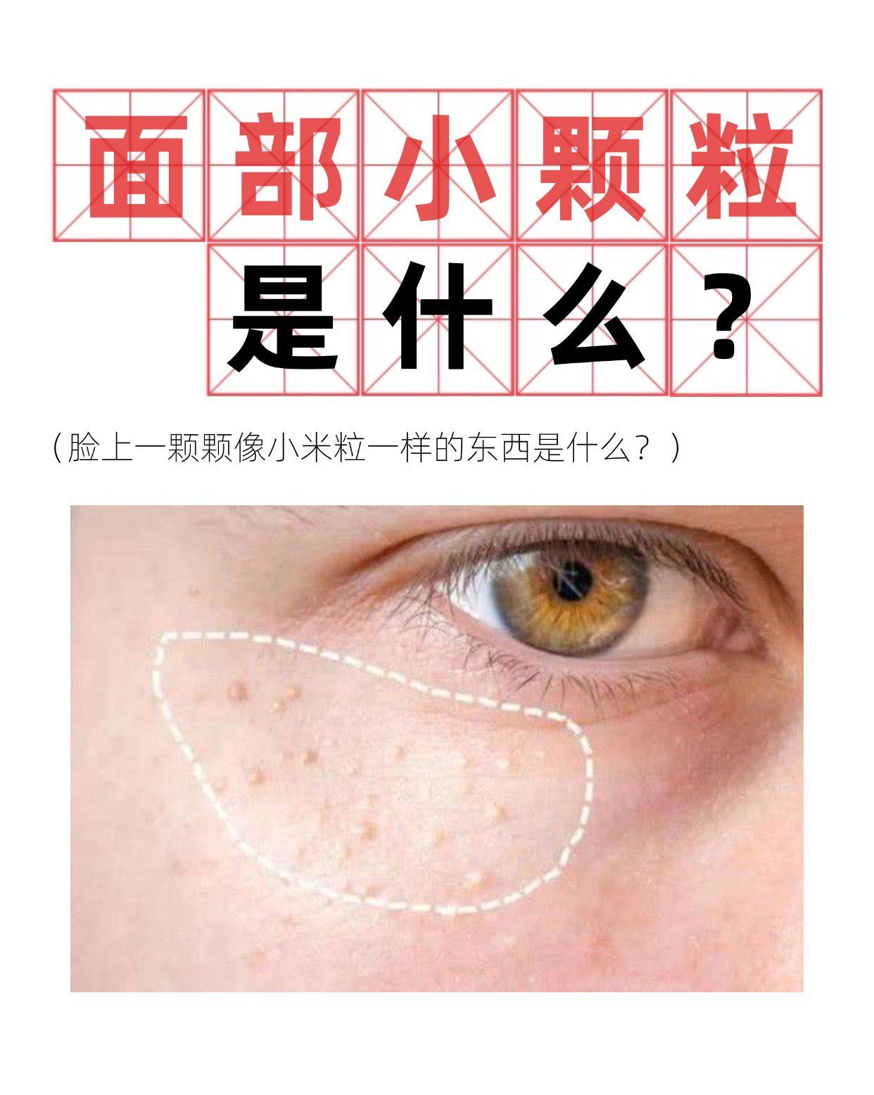 脸上一颗颗小颗粒是什么?