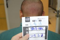 -大麦微针植发丨全国连锁