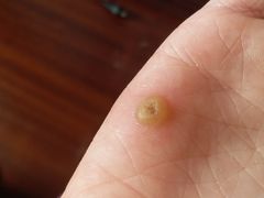 -杭州市第三人民医院