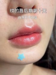 -德绣·机器野生眉发际线·美瞳线半永久