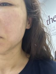 -海涛医疗美容·面部抗衰·注射美鼻