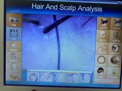 -黑奥秘脱发白发中心