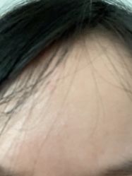 -成都西区医院整形美容