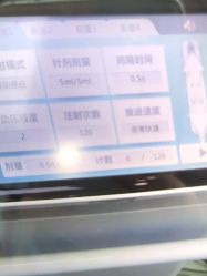 体验前-杭州米兰柏羽医疗美容医院