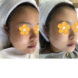 体验前-贞禾医美·连锁