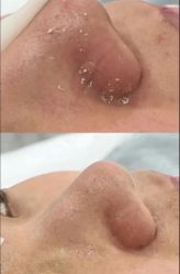 点击看大图 -SKIN79皮肤管理中心