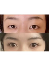 -紫洁俪方（北京）医疗美容