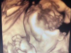 -复旦大学附属上海市第五人民医院·停车场