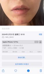 -海涛医疗美容·面部抗衰·注射美鼻