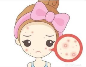 -蕾特恩·专业祛痘国际连锁