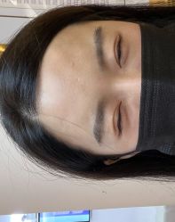 点击看大图 体验前-深圳美莱医疗美容医院