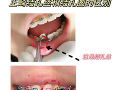 -极光口腔·矫正种植修复(锦江店)