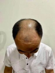 -发饰美男士增发补发假发定制店