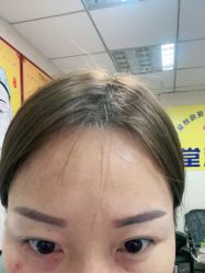 -北京美痣堂古方祛痣斑疣瘊