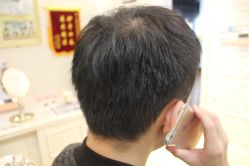 点击看大图 -大麦微针植发丨全国连锁