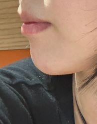 -广州美莱医疗美容医院